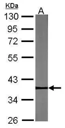 Anti-Pygopus 2 antibody used in Western Blot (WB). GTX120215