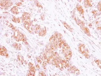 Anti-RAB35 antibody [N1C3] used in IHC (Paraffin sections) (IHC-P). GTX120294