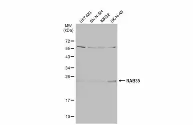 Anti-RAB35 antibody [N1C3] used in Western Blot (WB). GTX120294