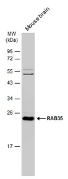 Anti-RAB35 antibody [N1C3] used in Western Blot (WB). GTX120294
