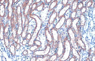 Anti-RAB35 antibody [N1C3] used in IHC (Paraffin sections) (IHC-P). GTX120294