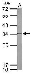 Anti-Nop25 antibody used in Western Blot (WB). GTX120303
