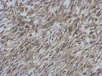 Anti-CCDC70 antibody [N1C3] used in IHC (Paraffin sections) (IHC-P). GTX120333