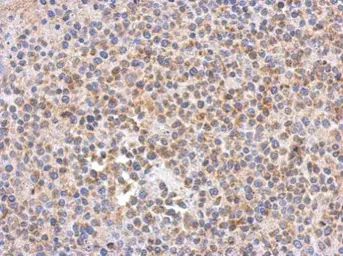 Anti-C9orf114 antibody [N2C3] used in IHC (Paraffin sections) (IHC-P). GTX120433