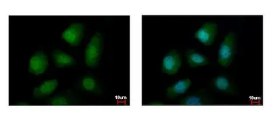 Anti-PELO antibody used in Immunocytochemistry/ Immunofluorescence (ICC/IF). GTX120446