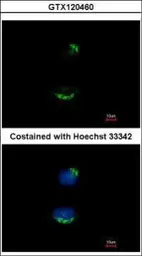 Anti-UBAC1 antibody [N2C3] used in Immunocytochemistry/ Immunofluorescence (ICC/IF). GTX120460
