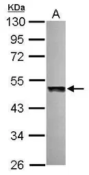 Anti-UBAC1 antibody [N2C3] used in Western Blot (WB). GTX120460