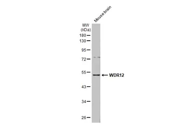 Anti-WDR12 antibody [N1C2] used in Western Blot (WB). GTX120474