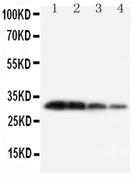 Anti-Kallikrein 1 antibody used in Western Blot (WB). GTX12058
