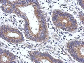 Anti-ENTPD7 antibody [N1N3] used in IHC (Paraffin sections) (IHC-P). GTX120593