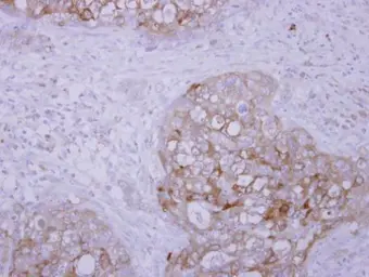 Anti-SCFD1 antibody [N2C1], Internal used in IHC (Paraffin sections) (IHC-P). GTX120605