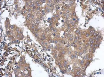 Anti-ANKLE2 antibody [N1N3] used in IHC (Paraffin sections) (IHC-P). GTX120698