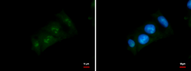 Anti-DDX52 antibody used in Immunocytochemistry/ Immunofluorescence (ICC/IF). GTX120797
