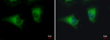 Anti-DYNC1LI1 antibody used in Immunocytochemistry/ Immunofluorescence (ICC/IF). GTX120806