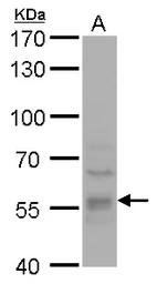 Anti-DYNC1LI1 antibody used in Western Blot (WB). GTX120806