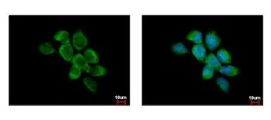 Anti-FAM120A antibody used in Immunocytochemistry/ Immunofluorescence (ICC/IF). GTX120824