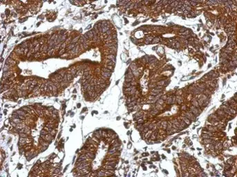 Anti-ORAI2 antibody used in IHC (Paraffin sections) (IHC-P). GTX120952
