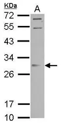 Anti-ORAI2 antibody used in Western Blot (WB). GTX120952
