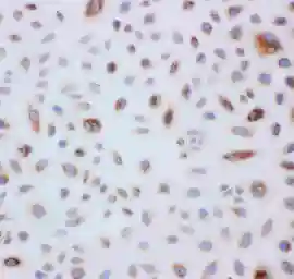 Anti-PRX III antibody used in IHC (Paraffin sections) (IHC-P). GTX12108