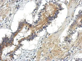 Anti-TBC1D15 antibody used in IHC (Paraffin sections) (IHC-P). GTX121081