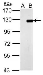 Anti-ZNF711 antibody used in Western Blot (WB). GTX121177