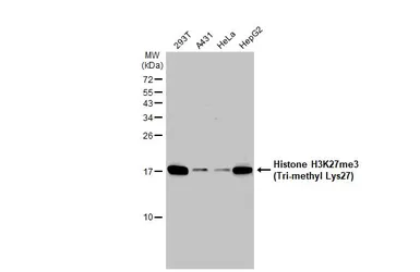 Anti-Histone H3K27me3 (Tri-methyl Lys27) antibody used in Western Blot (WB). GTX121184