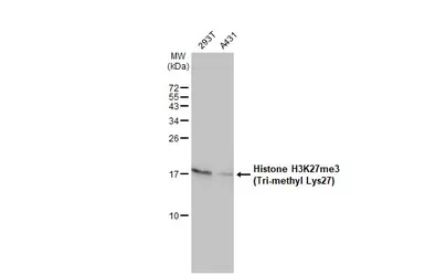 Anti-Histone H3K27me3 (Tri-methyl Lys27) antibody used in Western Blot (WB). GTX121184