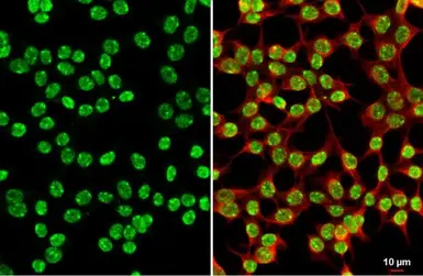Anti-Histone H3K27me3 (Tri-methyl Lys27) antibody used in Immunocytochemistry/ Immunofluorescence (ICC/IF). GTX121184