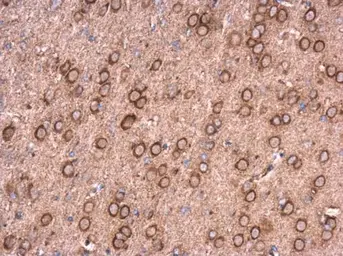 Anti-NCALD antibody used in IHC (Paraffin sections) (IHC-P). GTX121264