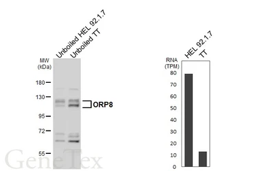 Anti-ORP8 antibody used in Western Blot (WB). GTX121273