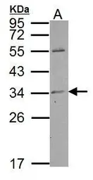 Anti-TPRG1L antibody used in Western Blot (WB). GTX121336