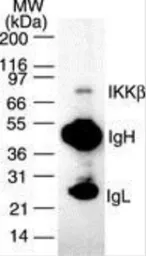 Anti-IKK beta antibody [10A9B6] used in Immunoprecipitation (IP). GTX12140