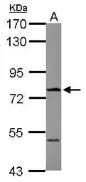 Anti-FBXO21 antibody used in Western Blot (WB). GTX121415