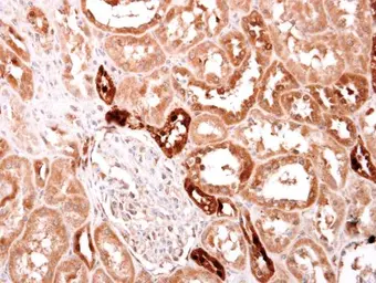 Anti-S100 alpha 2 antibody [N1C3] used in IHC (Paraffin sections) (IHC-P). GTX121457