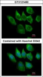 Anti-S100A6 antibody used in Immunocytochemistry/ Immunofluorescence (ICC/IF). GTX121460