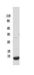 Human TFF1 protein, His tag. GTX121461-pro