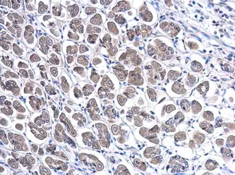 Anti-TFF1 antibody used in IHC (Paraffin sections) (IHC-P). GTX121461