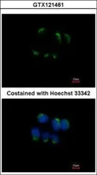 Anti-TFF1 antibody used in Immunocytochemistry/ Immunofluorescence (ICC/IF). GTX121461