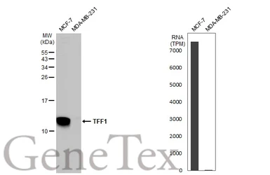 Anti-TFF1 antibody used in Western Blot (WB). GTX121461