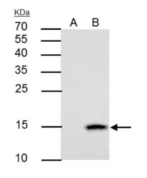 Anti-Galectin 7 antibody used in Immunoprecipitation (IP). GTX121475