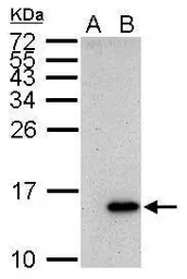 Anti-Galectin 7 antibody used in Western Blot (WB). GTX121475