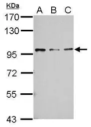 Anti-RASA4 antibody used in Western Blot (WB). GTX121563