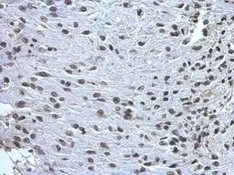 Anti-ZNF649 antibody used in IHC (Paraffin sections) (IHC-P). GTX121655