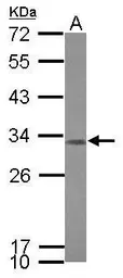 Anti-CCDC44 antibody [N1N3] used in Western Blot (WB). GTX121676