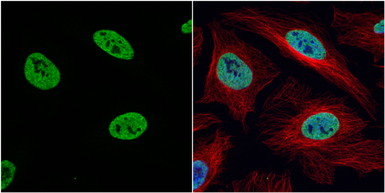 Anti-Histone H3K4me2 (Di-methyl Lys4) antibody used in Immunocytochemistry/ Immunofluorescence (ICC/IF). GTX121915