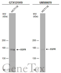 Anti-EGFR antibody [N1-2], N-term used in Western Blot (WB). GTX121919