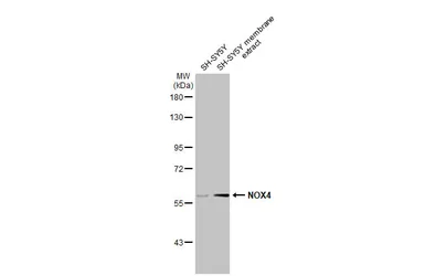 Anti-NOX4 antibody [N3C3] used in Western Blot (WB). GTX121929