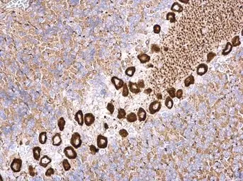 Anti-NME4 antibody used in IHC (Paraffin sections) (IHC-P). GTX121931