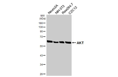 Anti-AKT antibody [N3C2], Internal used in Western Blot (WB). GTX121937