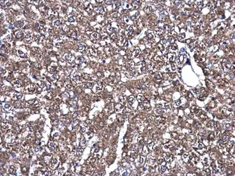 Anti-MEK1 + MEK2 antibody used in IHC (Paraffin sections) (IHC-P). GTX121942